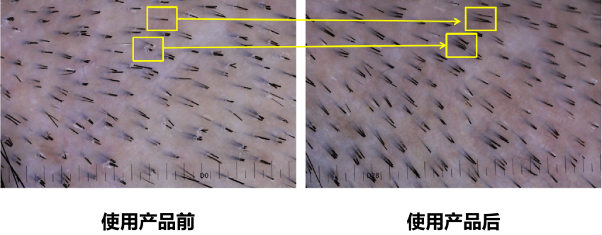 頭皮健康,紅斑,,丘疹,膿皰,評(píng)價(jià)方法