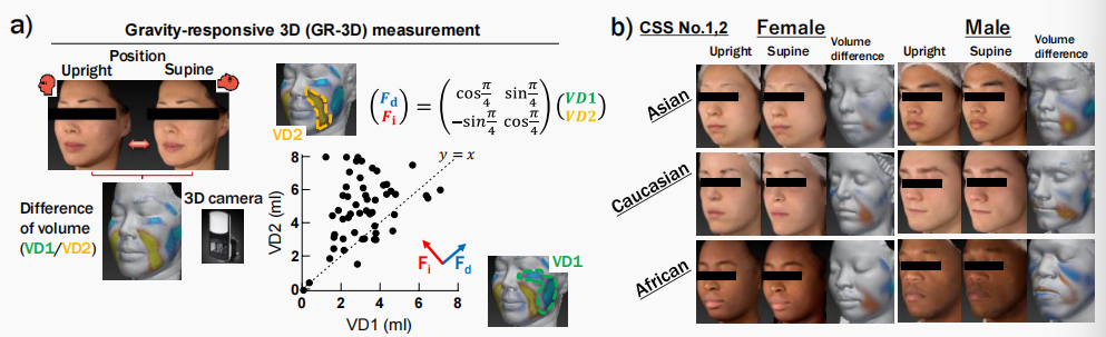 CIRS功效評價,技術實踐,下垂,水腫,定量評估